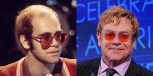 Elton-John-before-after