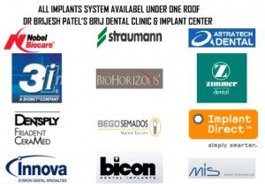 Best dental implant systems