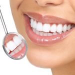 Healthy smile with crowns - 